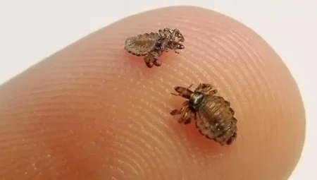 What Does It Mean to See Lice in a Dream?
